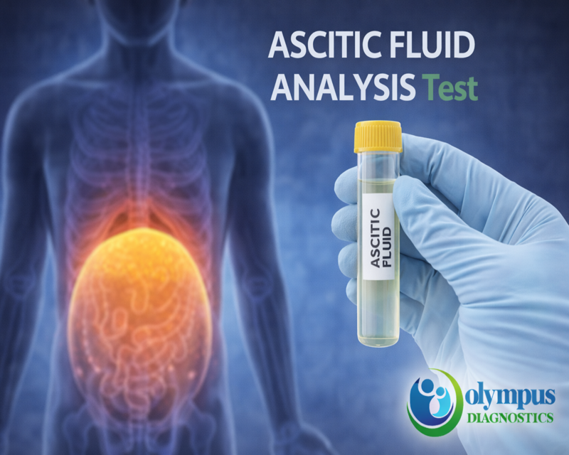 ASCITIC FLUID ANALYSIS