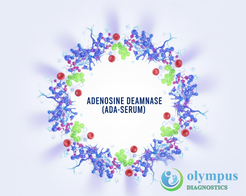 Adenosine Deaminase (ADA-Serum)