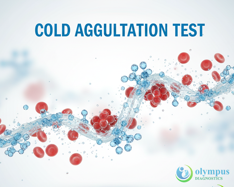 COLD AGGLUTINATION TEST
