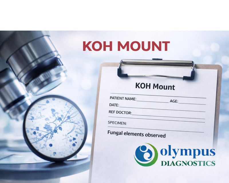 KOH MOUNT