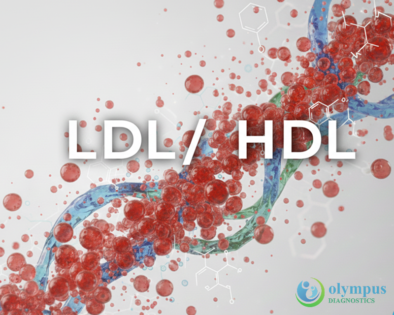 LDL/HDL